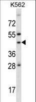 ADORA1 / Adenosine A1 Receptor Antibody (aa298-326)