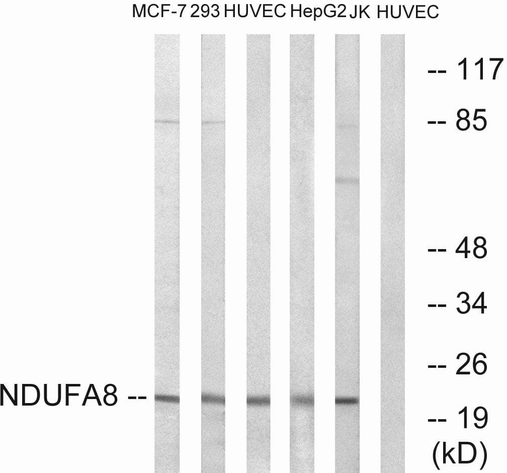 Polyclonal Rabbit anti-Human NDUFA8 Antibody (IHC, WB)