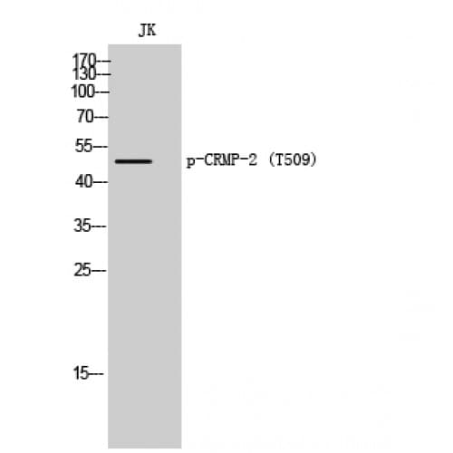DPYSL2 / CRMP2 Antibody (450-530 aa)