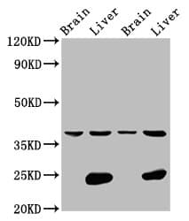 LSAMP / LAMP Antibody