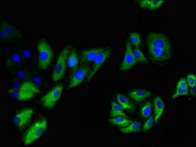 Polyclonal Rabbit anti-Human NINJ1 / Ninjurin Antibody