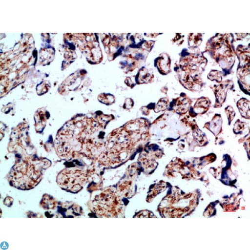 ALK-6 / BMPR1B Antibody