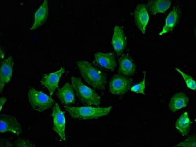 CAV2 / Caveolin 2 Antibody