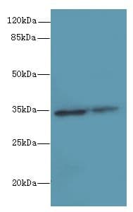 Polyclonal Rabbit anti-Human RNF148 Antibody (IHC, WB)