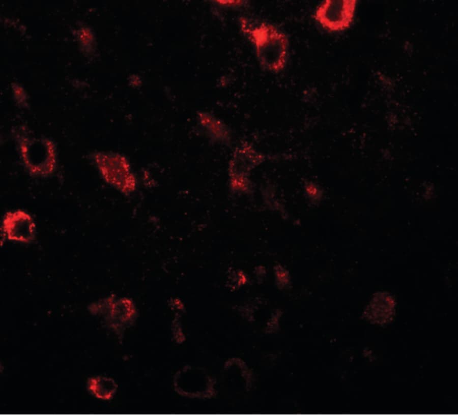 IHC-plus™ CIITA Antibody