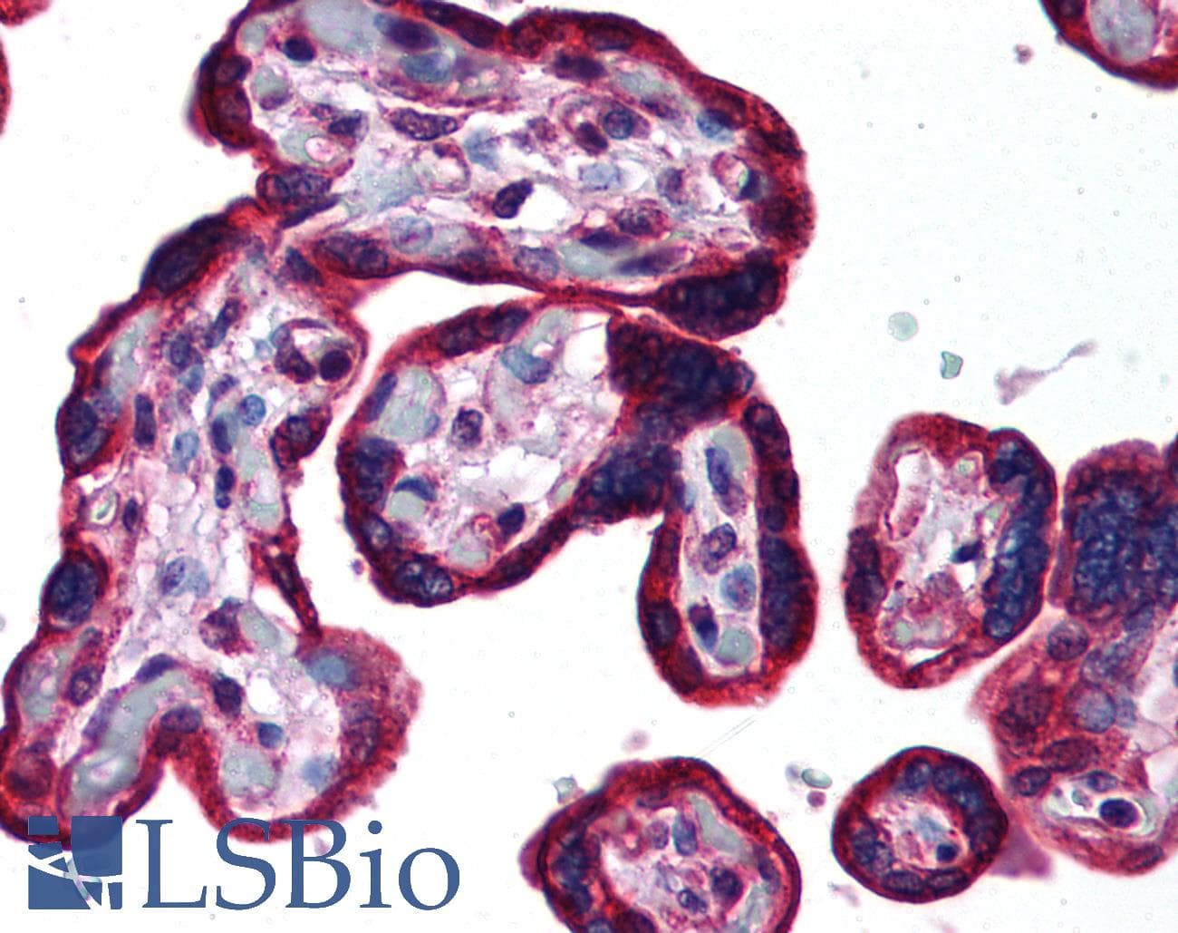 IHC-plus™ KRT19 / CK19 / Cytokeratin 19 Antibody (aa21-40)