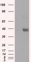 Monoclonal Mouse anti-Human LOX / Lysyl Oxidase Antibody (clone OTI6B11, IHC, IF, WB)
