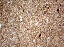 NUMB Antibody (aa1-365, clone OTI3E5)
