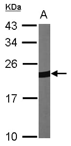Polyclonal Rabbit anti-Human PRDX1 / Peroxiredoxin 1 Antibody (IF, WB)