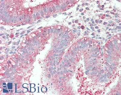 IHC-plus™ SIPA1L3 Antibody (aa1-50)