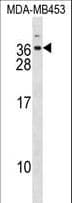 Polyclonal Rabbit anti-Human DLX6 Antibody (aa91-119, WB)