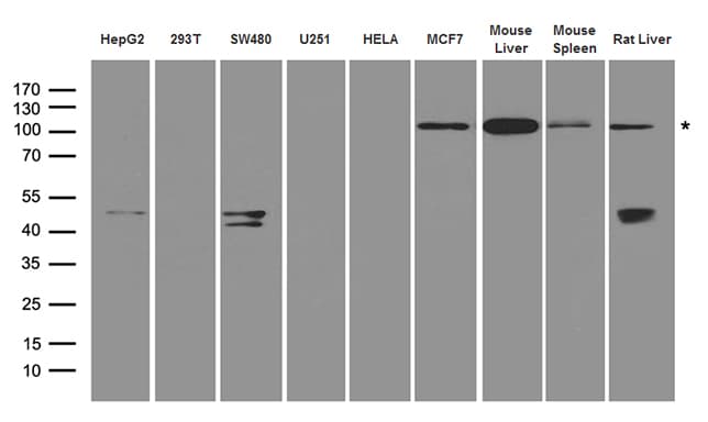 IKBKB / IKK2 / IKK Beta Antibody