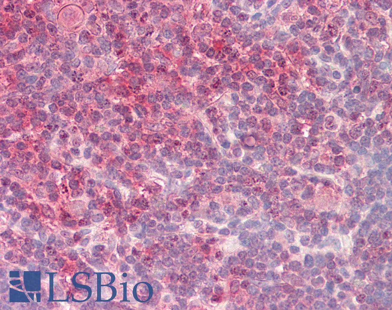 IHC-plus™ CRTC2 / TORC2 Antibody (aa83-96)
