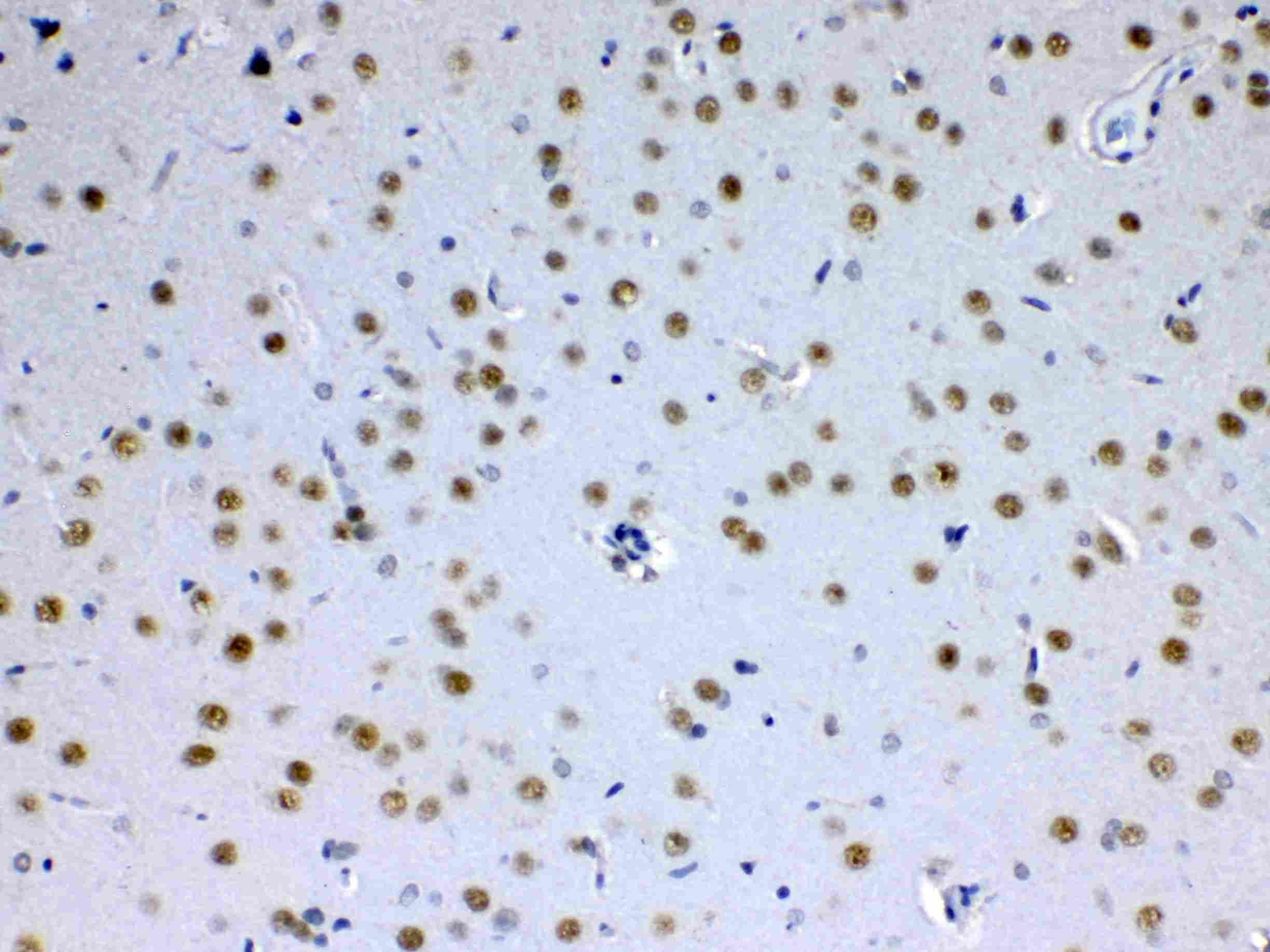 MED15 / ARC105 Antibody
