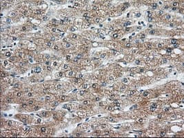 KHK / Ketohexokinase Antibody (clone OTI4E9)