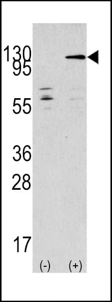 TAOK3 / JIK Antibody (aa671-700)