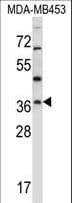 Polyclonal Rabbit anti-Human RNF144A / RNF144 Antibody (aa156-184, IHC, WB)