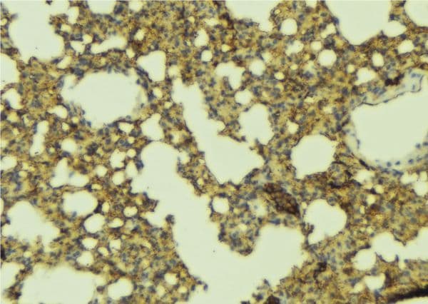 LEPR / Leptin Receptor Antibody
