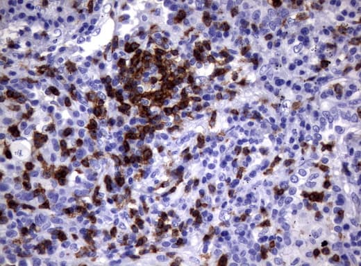CD2 Antibody (clone UMAB86)