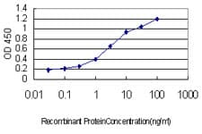IHC-plus™ TOPORS Antibody (clone 5G11)