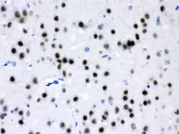 MEF2A / MEF2 Antibody