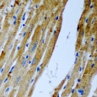 CCM2 / Malcavernin Antibody