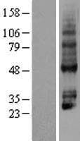 P2RY4 / P2Y4 Protein (Over-Expression Lysate Myc-DDK (Flag))