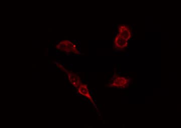 Polyclonal Rabbit anti-Human WAS / WASP Antibody (IHC, IF, WB)