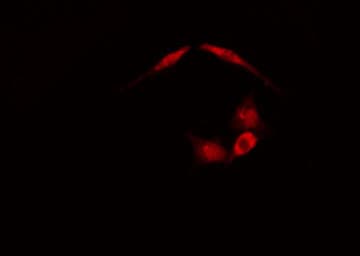 Polyclonal Rabbit anti-Human ALDOA / Aldolase A Antibody (IF, WB)