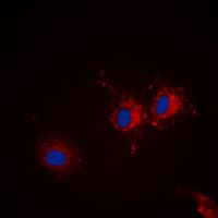 IHC-plus™ Polyclonal Rabbit anti-Human STXBP1 / MUNC18-1 Antibody (Internal, IHC, IF, WB)