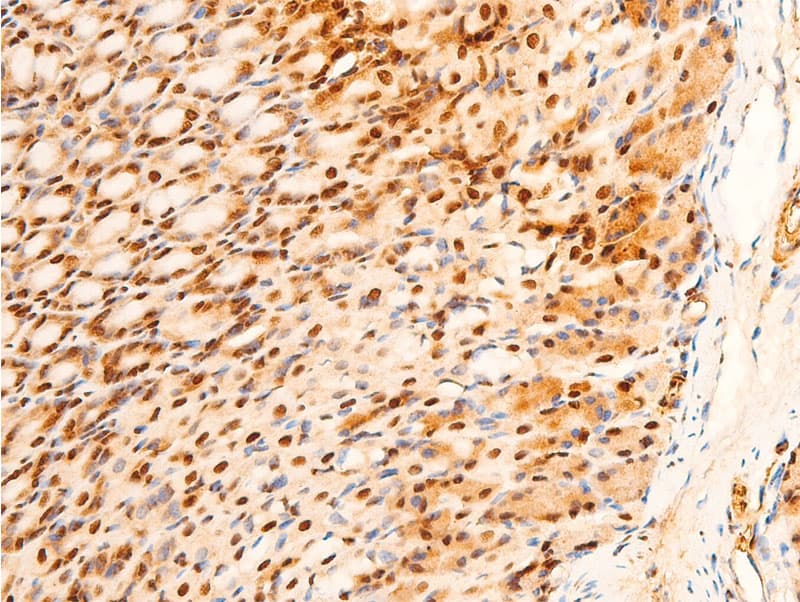 JUN / c-Jun Antibody (phospho-Ser243)