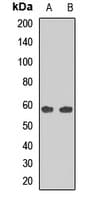 Polyclonal Rabbit anti-Human PRDM11 Antibody (WB)