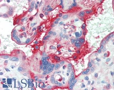 IHC-plus™ CFH / Complement Factor H Antibody