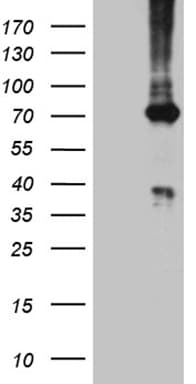 PGM2L1 Antibody (clone OTI4G6)