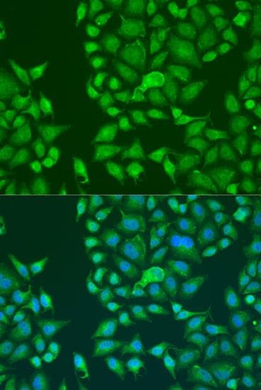 STAU2 Antibody