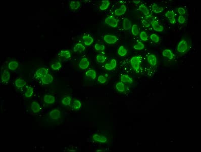 HIST1H2BN Antibody