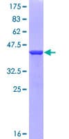 Human SPECC1 / CYTSB Protein (Recombinant GST, N-terminus)