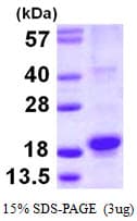 Human RGS21 Protein (Recombinant His)