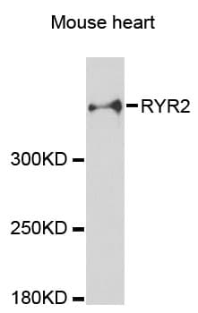 RYR2 / Ryanodine Receptor 2 Antibody