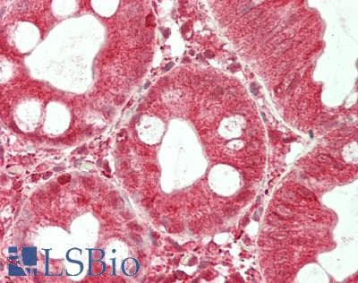 IHC-plus™ SLC46A1 / HCP1 Antibody (aa225-275)