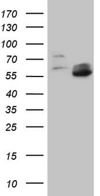 Monoclonal Mouse anti-Human MMP3 Antibody (clone OTI1E9, aa246-477, IHC, WB)