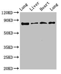 Polyclonal Rabbit anti-Human LOXL2 Antibody (IHC, WB)