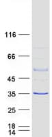 Human RAB40B Protein (Recombinant Myc-DDK (Flag))
