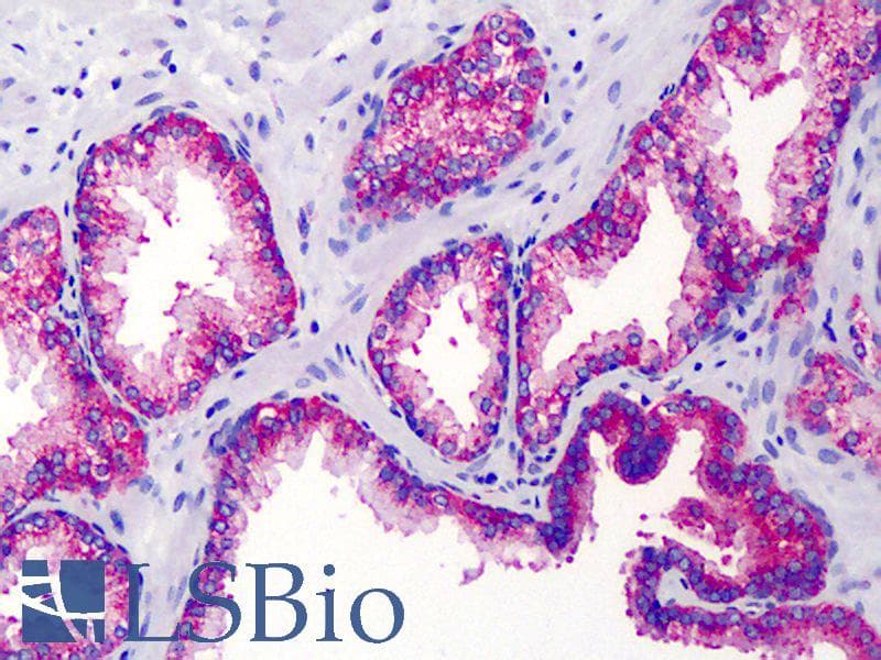 IHC-plus™ IKBKG / NEMO / IKK Gamma Antibody (clone 46B844)
