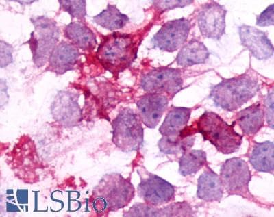 PathPlus™ Polyclonal Rabbit anti-Human BDKRB2/Bradykinin B2 Receptor Antibody (C-Terminus, IHC)