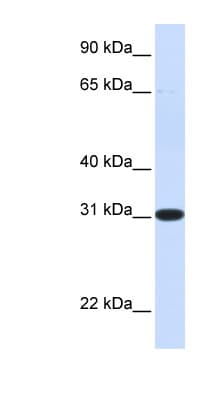 MAWDBP / PBLD Antibody (N-Terminus)