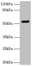 GC / Vitamin D-Binding Protein Antibody (aa305-474)