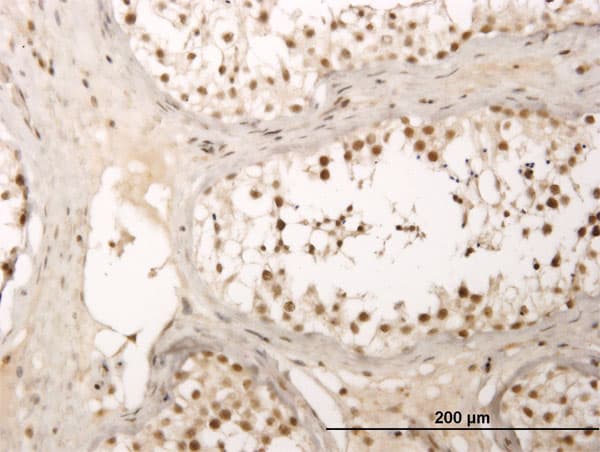 Monoclonal Mouse anti-Human ZNF213 Antibody (clone 5D7, IHC, WB)