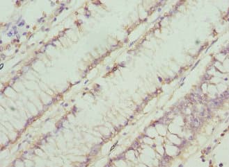 CHN1 Antibody