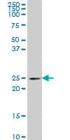 IHC-plus™ Monoclonal Mouse anti-Human PCMT1 Antibody (clone 4G9, IHC, WB)